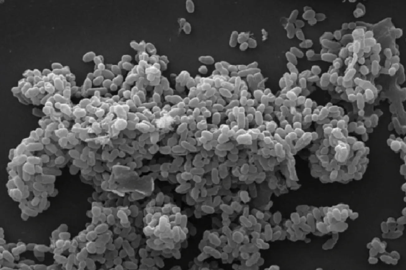 How Akkermansia Supports Gut Lining Health and the Oral–Gut Axis