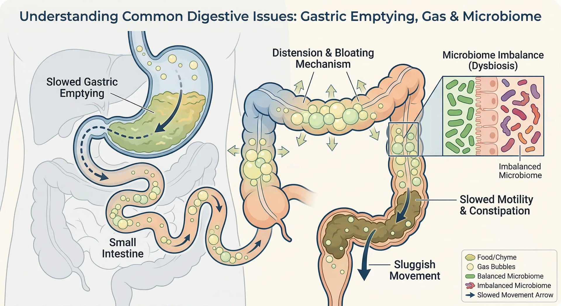 GLP-1 Side Effects: How to Ease Bloating and Constipation